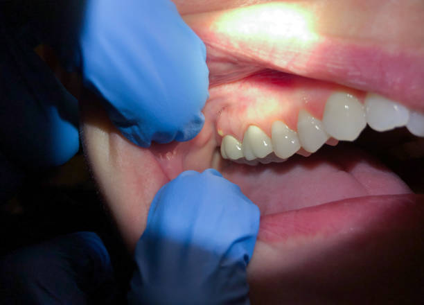 Best Cracked Tooth Emergency Dentist  in Loves Park, IL